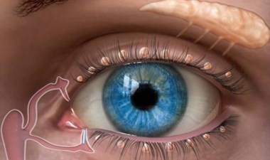 Gözyaşı kanalı tıkanıklığı enfeksiyona neden olurken gündelik yaşamı olumsuz şekilde etkiliyor: Gereksiz operasyonlar tedaviyi zorlaştırıyor